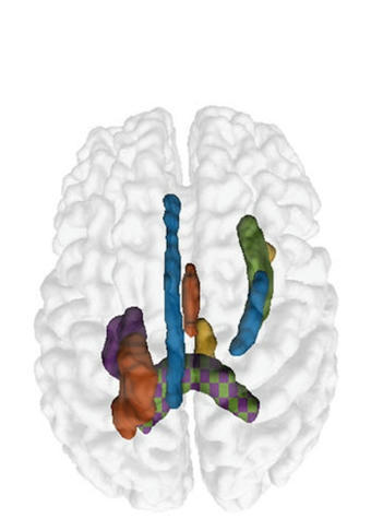 ACR Releases Updated Fluoroscopy Patient Radiat