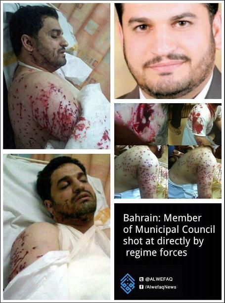Nearly 130 birdshot wounds by riot police in the body of councillor Sadiq Rabie