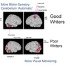 Brain and Management