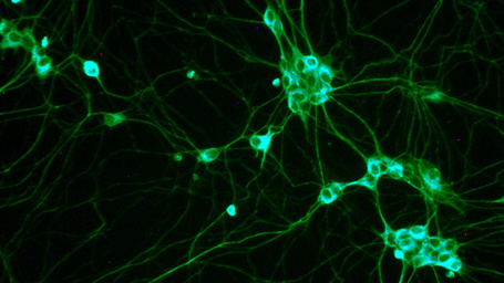 Scientists may have discovered how cancer spreads around the body | Tracking the Future | Scoop.it