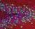 Discovery may lead to new treatment for ALS | Mom Psych | Scoop.it