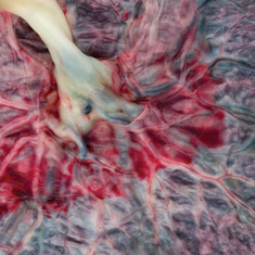 Fetal Armor: How the Placenta Shapes Brain Development: Scientific American | Early Brain Development | Scoop.it