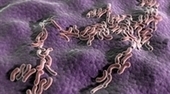 Pathogenesis, diagnostic testing, and management of mononucleosis - Journal of the American Academy of Physician Assistants | CME-CPD | Scoop.it