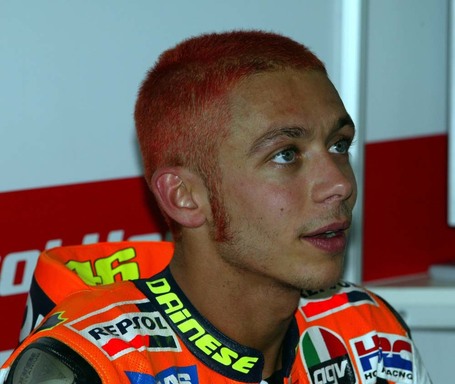 Brain Surgery: Rossi Approves | SuperbikePlanet.com | Ductalk | Scoop.it