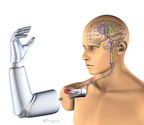 A novel thought-controlled prosthesis for amputees | KurzweilAI | Knowmads, Infocology of the future | Scoop.it