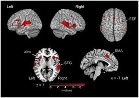 Neural Correlates of Sound Localization in Complex Acoustic Environments | Social Foraging | Scoop.it
