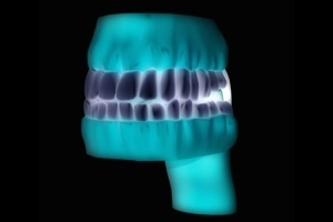 New At The Dentist: 3D Printing &ldquo;Dental Crowns While You Wait&rdquo; | Longevity science | Scoop.it