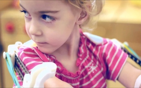 3D Printer Creates 'Magic Arms' For Two-Year-Old Girl | 3D Prototyping | Scoop.it
