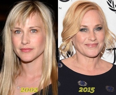 Jennifer Jason Leigh Plastic Surgery Before And