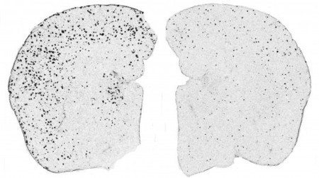 Scientists successfully treat Alzheimer&rsquo;s symptoms in mice | Longevity science | Scoop.it