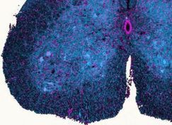 ALS: Forscher entdecken neuen Mechanismus | ALS (Amyotrophe Lateralsklerose) | Scoop.it