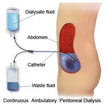 Dialysis Technician School