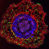 Plant Immunity And Microbial Effectors
