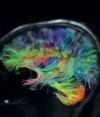 Neuroscience: Making connections | Visualization in Science & Education | Scoop.it