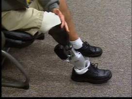 Local company introduces bionics | Robots and Robotics | Scoop.it