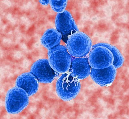 New light on the problem of antibiotic resistance | Infectious Answers | Scoop.it