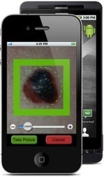 Mobile Health Around the Globe: Monitoring Melanoma with a Mobile | Progress in Mobile Health | Scoop.it
