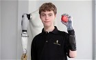 FORMULA ONE 2011 F1 NEWS:F1 fan receives bionic hand from Mercedes team - Telegraph | F1 news | Scoop.it