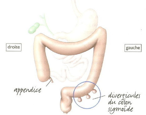 radiotherapie most cancers poumon effet secondaire