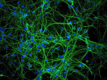 &iquest;Qu&eacute; hay de cierto en el uso del 10% del cerebro? | Vulbus Incognita Magazine | Scoop.it