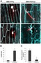 The Ustilago maydis Effector Pep1 Suppresses Plant Immunity by Inhibition of Host Peroxidase Activity | Plant Immunity And Microbial Effectors | Scoop.it