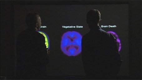 Vegetative patient 'not in pain' | HealingAndTheMind | Scoop.it