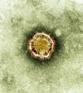 U.S. warns health officials to be alert for deadly new virus | SHEPHERD Health Care Update | Scoop.it