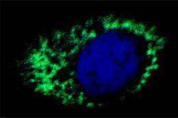 Discovery may lead to mitochondria syndrome treatment | Scientific Discovery | Scoop.it