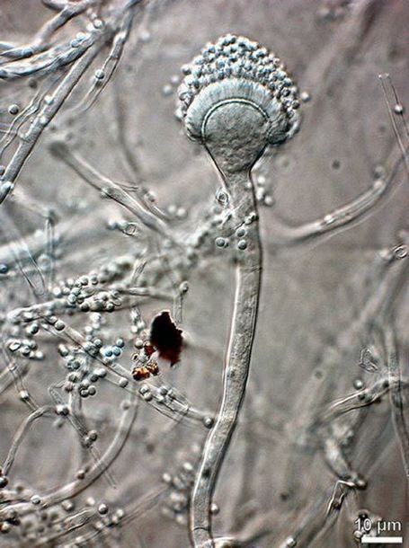 Aspergillus felis: New Fungus Found in Australia, Causes Infections in Humans, Cats | Biology | Sci-News.com | this curious life | Scoop.it