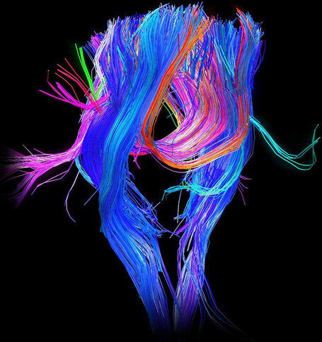 Human Connectome Project&nbsp; | Integral Evolution | Scoop.it