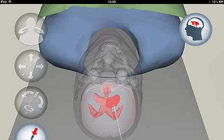 Free iPad App Helps Train Future Neurosurgeons | E-Learning, M-Learning | Scoop.it