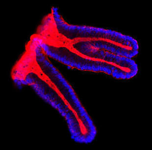 53 hospitales analizan cuatro marcadores para mejorar el tratamiento del cancer de colon | Ciencia & Curiosidades | Scoop.it