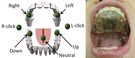 Now your tongue can secretly operate a computer, wheelchair | My Personal Interests | Scoop.it