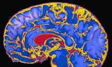 Childhood stimulation key to brain development, study finds | Positive futures | Scoop.it