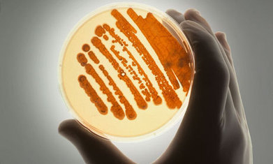 UK raises alarm on deadly rise of superbugs | Infectious Answers | Scoop.it