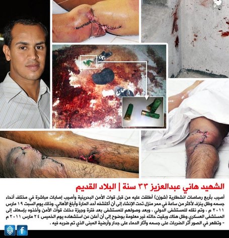 Hani Abdul Aziz murdered with ball bearings shot from shotguns by the Bahrain regime! | Human Rights and the Will to be free | Scoop.it
