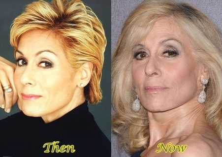 Jennifer Jason Leigh Plastic Surgery Before And...