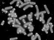'Biobank' Data Reveal Intriguing Link Between Telomeres, Death Risk | Open Knowledge | Scoop.it
