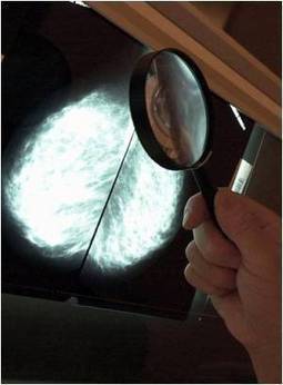 One in Six Cancers are Caused by Infection: Study | MedIndia | Patient Safety in Medical and Dental Environments | Scoop.it