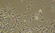 Cancer can teach us about our own evolution | Complex Insight  - Understanding our world | Scoop.it