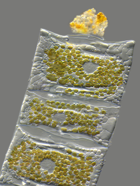 Extraordinary Microscope Photographs | Wiki_Universe | Scoop.it