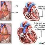 How Does Alcohol Affect the Heart? | Alcohol Addictions | Scoop.it