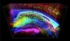 Transparent Brain Imaging Will Accelerate Research 10 to 100 Times | Chair et M&eacute;tal - L'Humanit&eacute; augment&eacute;e | Scoop.it