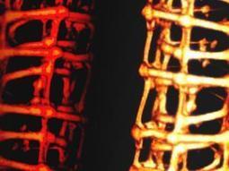 Cyborg tissue is half living cells, half electronics - tech - New Scientist | Composing The Future | Scoop.it