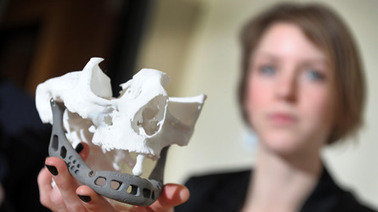 Une m&acirc;choire artificielle cr&eacute;&eacute;e gr&acirc;ce &agrave; l'imagerie 3D | Belgitude | Scoop.it