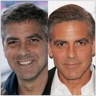 Botox Botulino per l'Uomo - Cancellare Rughe e Segni del Tempo [Dr. P. Martinelli] | VisoGiovane.it | Scoop.it