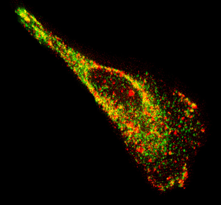 Single molecule visualization in combination with next gen sequencing finds 2,500 new RNAs inside neurons | Amazing Science | Scoop.it