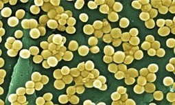 Compound increases antibiotic effectiveness against MSRA | Vaccine News Daily | Research from the NC Agricultural Research Service | Scoop.it
