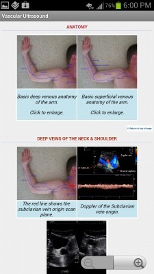 Aprender el arte de la #ecograf&iacute;a con Android App Ultrasoundpaedia, | Salud Social Media | Scoop.it