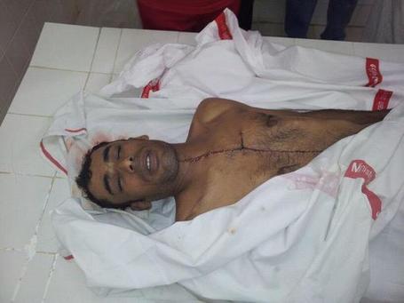 Bahrain Martyr:  Al-Zahir Ahmed Abdul Nabi | Human Rights and the Will to be free | Scoop.it